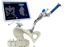 Computer Assisted Joint Replacement