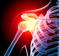 Shoulder Pain