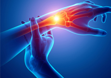 Sports Injury Management of Hand, Wrist and Elbow